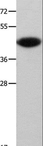 MAP2K6 / MEK6 / MKK6 Antibody
