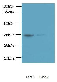 RFPL3 Antibody