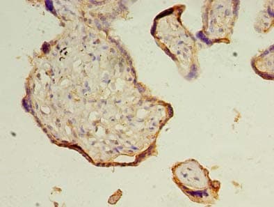 Polyclonal Rabbit anti-Human TRAPPC3 Antibody (IHC)