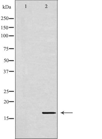 UBE2D1 / UBCH5 Antibody