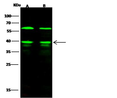 Polyclonal Rabbit anti-Human HNRNP-E2 / PCBP2 Antibody (Preservative Free, IHC, WB)