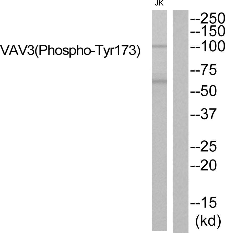 VAV3 Antibody (phospho-Tyr173)