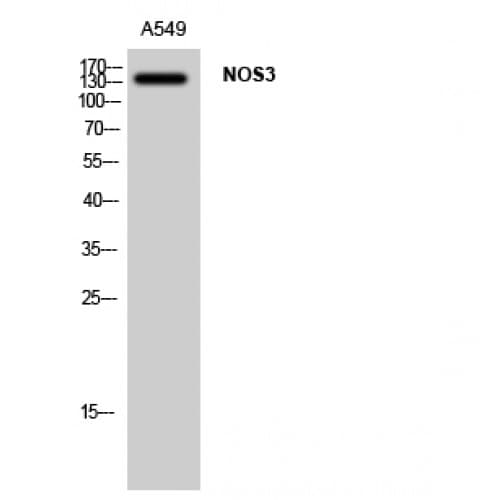 Polyclonal Rabbit anti-Human NOS3 / eNOS Antibody (1120-1200 aa, IF, WB)