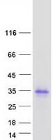 Human LDLRAD1 Protein (Recombinant Myc-DDK (Flag))