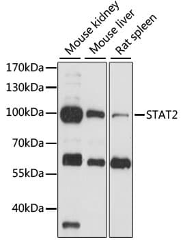 Polyclonal Rabbit anti-Human STAT2 Antibody (WB)