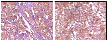 Monoclonal Mouse anti-Human EPHB4 / EPH Receptor B4 Antibody (clone 5B8F7, IHC, WB)