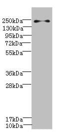 PLA2R / PLA2R1 Antibody