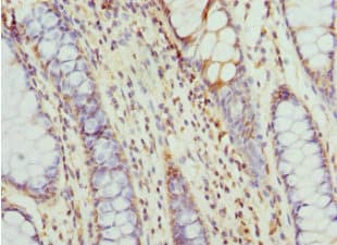 CCT5 / TCP1 Epsilon Antibody
