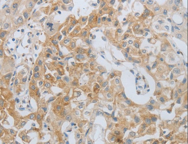 MMP25 / Leukolysin Antibody