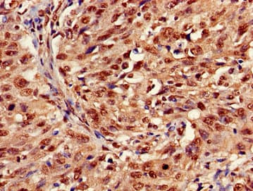 HIST1H3A Antibody
