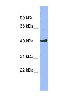 Polyclonal Rabbit anti-Human SERPINB13 / HUR7 Antibody (aa107-156, WB)