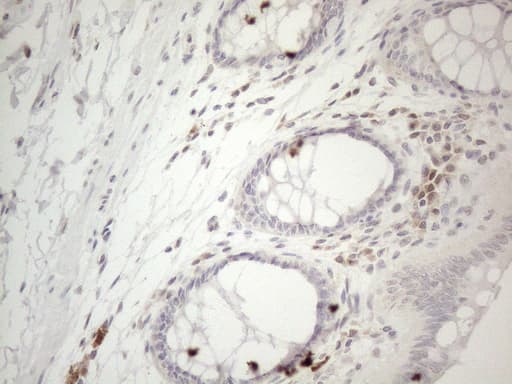 Monoclonal Mouse anti-Human LPIN1 / Lipin 1 Antibody (clone OTI1B2, aa1-274, IHC, WB)