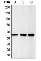 CHEK1 / CHK1 Antibody (Internal)