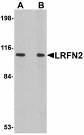 IHC-plus™ LRFN2 Antibody