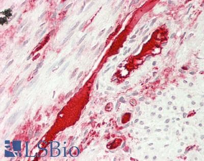 IHC-plus™ Polyclonal Rabbit anti-Human TF / Transferrin Antibody (aa20-698, IHC, WB)