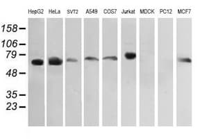 Monoclonal Mouse anti-Human RIOK2 Antibody (clone OTI3E11, IHC, IF, WB)
