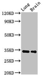 MGLL / Monoacylglycerol Lipase Antibody