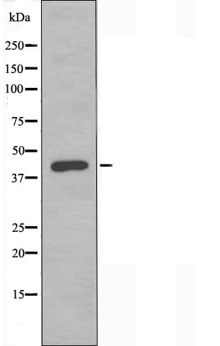 Polyclonal Rabbit anti-Human SEPT2 / Septin 2 Antibody (IF, WB)