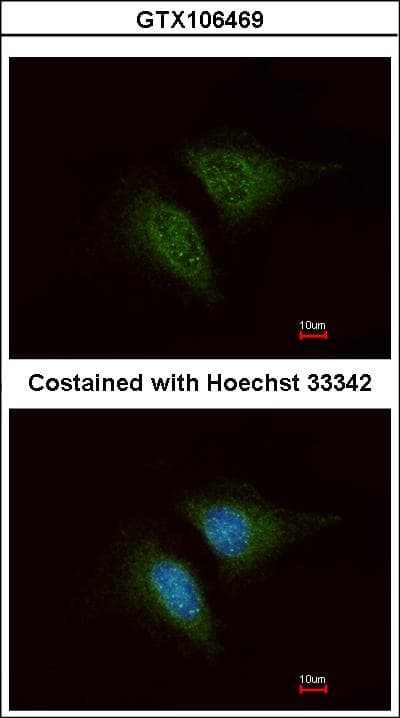 Polyclonal Rabbit anti-Human CORO1C Antibody (aa411-474, IHC, WB)