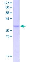 Human HES5 Protein (Recombinant GST, N-terminus)
