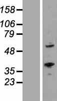 RORA / ROR Alpha Protein (Over-Expression Lysate Myc-DDK (Flag))
