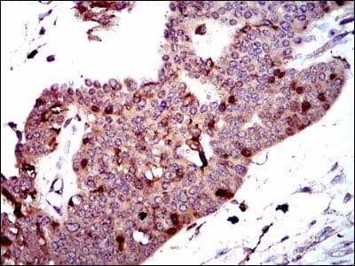 PBK / TOPK Antibody (clone 2C8)
