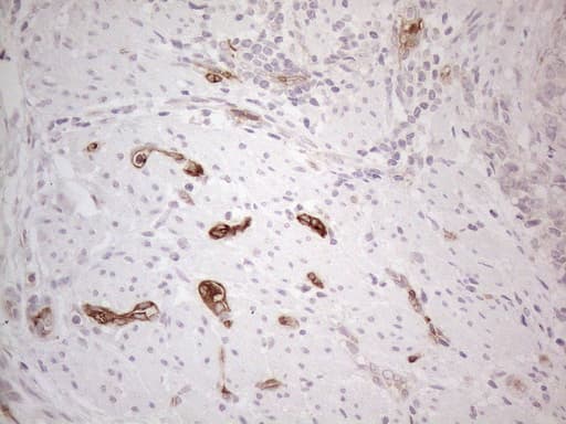 NOBOX Antibody (aa1-271, clone OTI4C5)