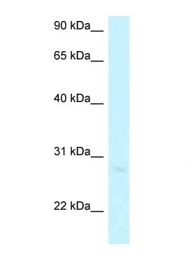 Polyclonal Rabbit anti-Human ABHD12B Antibody (aa204-253, WB)