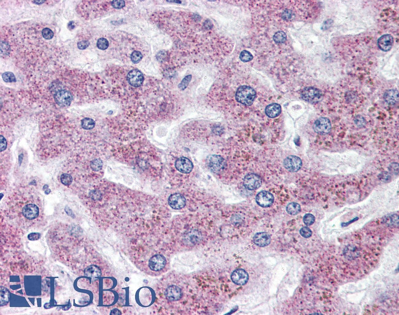 IHC-plus™ Polyclonal Rabbit anti-Human SLC5A11 / SMIT2 Antibody (Internal, IHC)