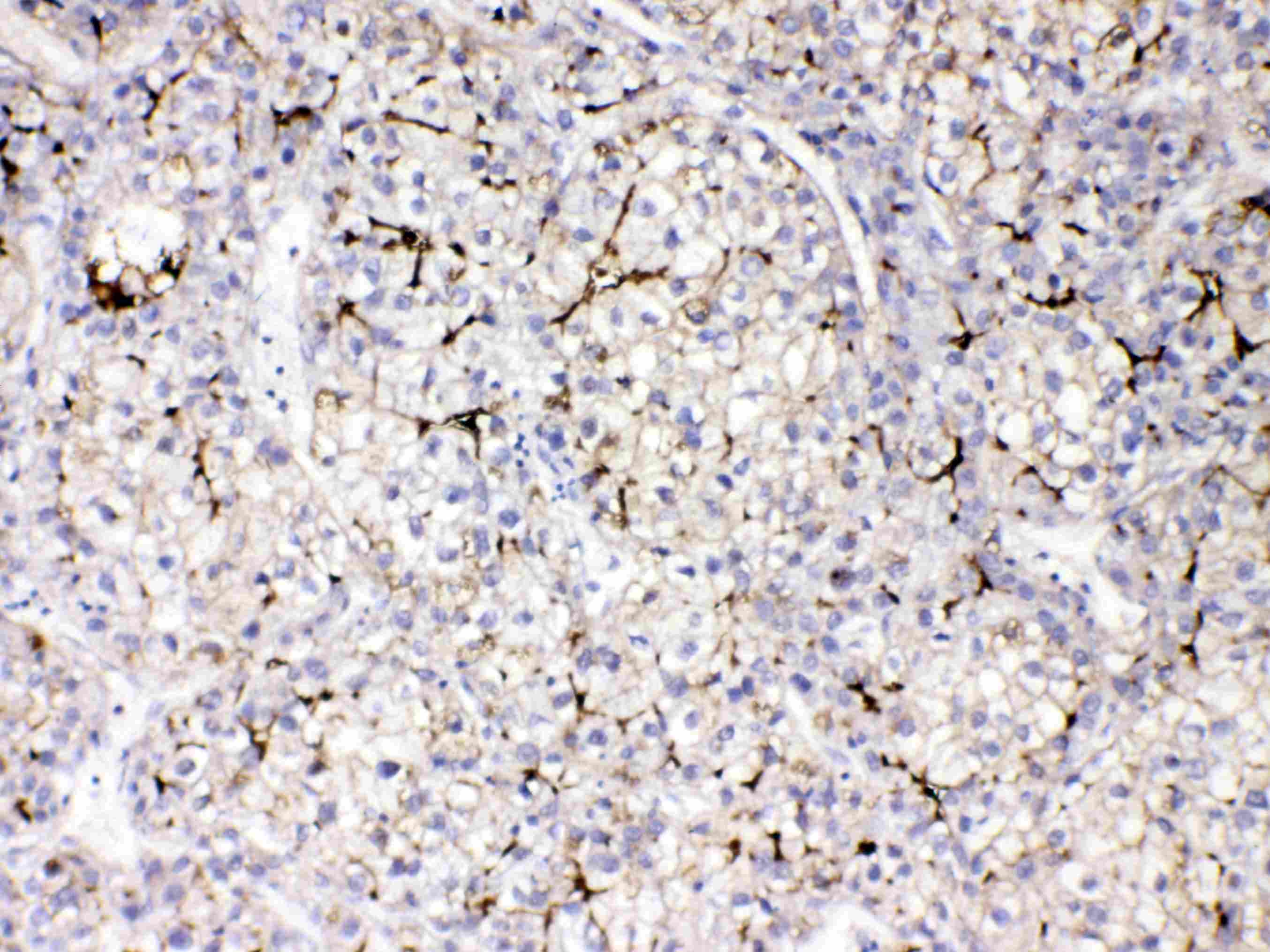 Polyclonal Rabbit anti-Human APOB / Apolipoprotein B Antibody (IHC, WB)