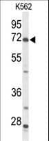 Polyclonal Rabbit anti-Human ACSS2 / ACAS2 Antibody (aa31-60, IHC, WB)