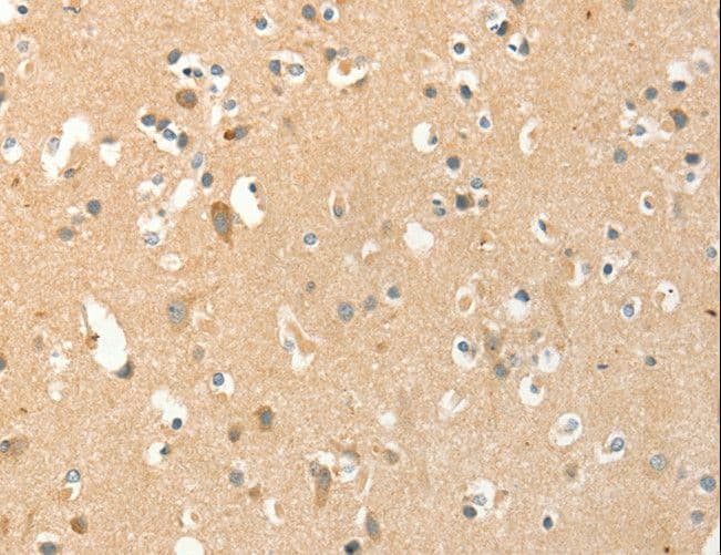 Polyclonal Rabbit anti-Human AANAT Antibody (IHC)