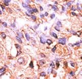 Polyclonal Rabbit anti-Human PPM1F Antibody (aa409-439, IHC, WB)
