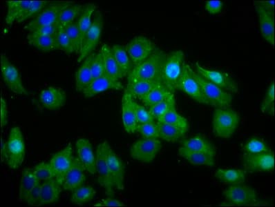 Polyclonal Rabbit anti-Human OPN1MW / GCP Antibody (IF, WB)