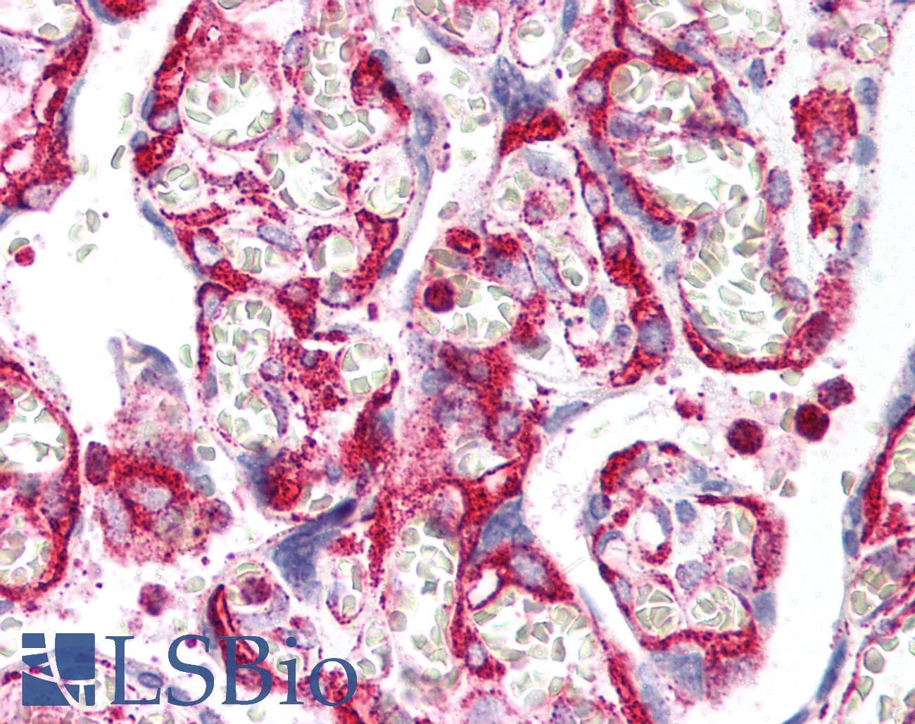 IHC-plus™ INHA / Inhibin Alpha Antibody (clone 4A2)