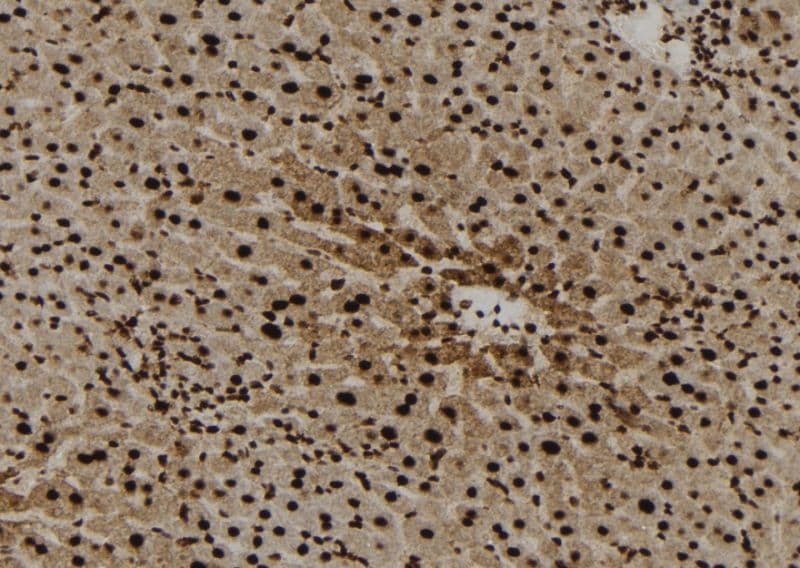 Polyclonal Rabbit anti-Human E-FABP / FABP5 Antibody (IHC, WB)
