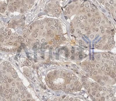 CASP7 / Caspase 7 Antibody