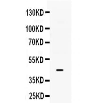 B3GNT8 Antibody (aa360-397)