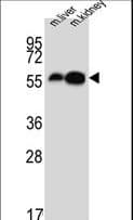 Polyclonal Rabbit anti-Human DDC / DOPA Decarboxylase Antibody (aa32-61, IHC, IF, WB)