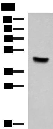 Polyclonal Rabbit anti-Human KCTD7 Antibody (WB)