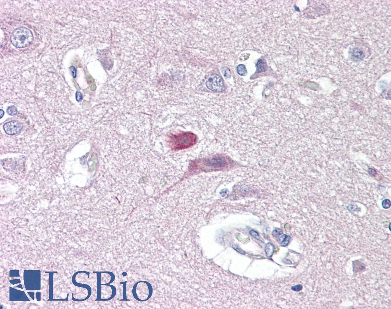 IHC-plus™ Polyclonal Rabbit anti-Human GRM4 / MGLUR4 Antibody (aa851-900, IHC, WB)