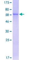 Human PON3 Protein (Recombinant GST)