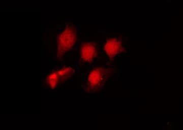 Polyclonal Rabbit anti-Human HDAC6 Antibody (phospho-Ser22, IHC, IF, WB)