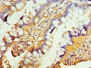 TNFRSF13B / TACI Antibody (aa184-293)