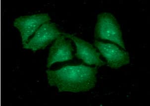 Monoclonal Mouse anti-Human KCTD15 Antibody (clone AT2B11, WB)
