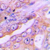 Polyclonal Rabbit anti-Human FOXO1 / FKHR Antibody (Internal, IHC, IF, WB)