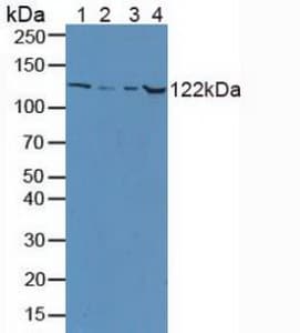 CP / Ceruloplasmin Antibody (aa872-1059)