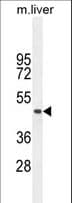TMEM229A Antibody (aa158-186)