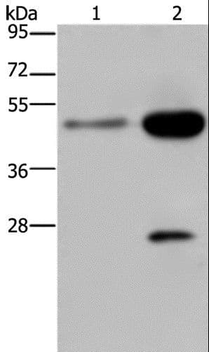 Polyclonal Rabbit anti-Human NK1 / CD160 Antibody (IHC, WB)