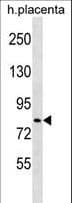 HECTD2 Antibody (aa203-232)
